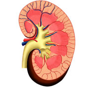 IgA Nephropathy Diagnosed