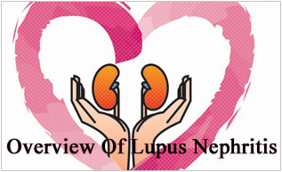 Overview Of Lupus Nephritis
