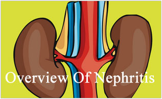 Overview Of Nephritis