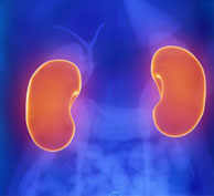 Nephrotic Syndrome Causes