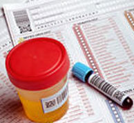 Nephrotic Syndrome Diagnosed