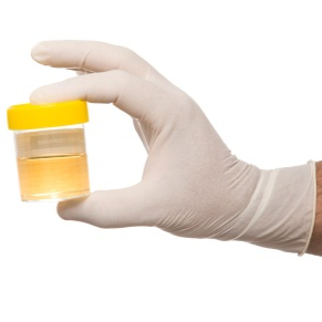 Urine Change In Kidney Failure