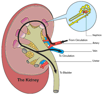 What Causes Kidney Failure