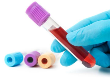 Urine and Blood Tests For Diabetic Nephropathy