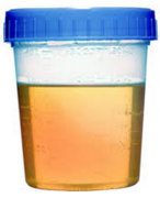Causes and Treatment for Hematuria In PKD