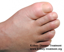 Causes and Treatment for Renal Edema in Kidney Disease