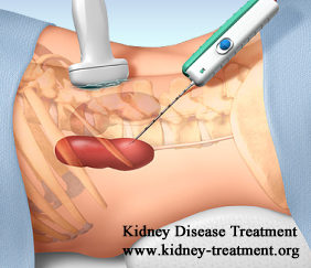 How To Diagnose FSGS