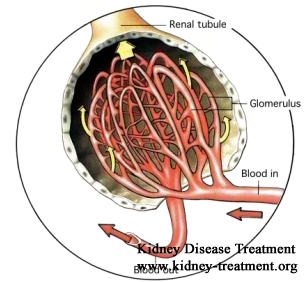 What Is the Average Creatinine Level In Stage 3 Kidney Disease