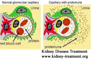 How to Lower Protein Leakage