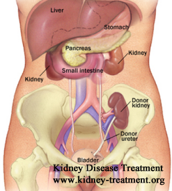 IgA Nephropathy Comes Back Easily after Kidney Transplant