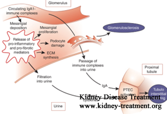 How to deal with IgA Nephropathy with FSGS