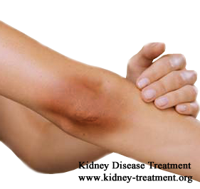 Why Does Skin Get Darker on Dialysis Patient