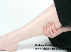 Does Lupus Nephritis Cause Edema in Legs