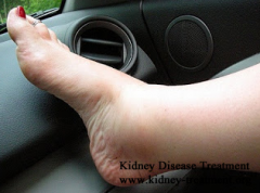 34 Years Old, CKD Stage 3, Swelling in Hands, Feet and Face