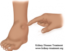 Swelling and Hypertension Nephropathy