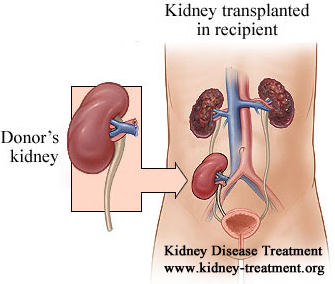 Life Expectancy After Renal Transplant for a PKD Patient Aged 20