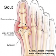 Can FSGS Cause the Symptom of Gout