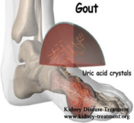 What are the Symptoms of Gout for CKD Patients