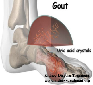 are the symptoms of gout for chronic kidney disease ckd patients gout 
