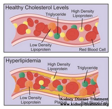 Management of Hyperlipidemia for Nephrotic Syndrome Patients