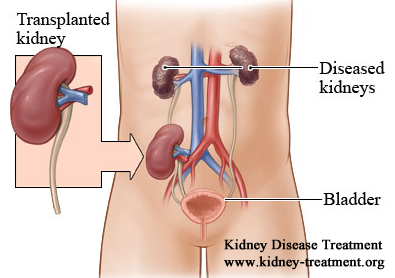 Complications of Kidney Transplant