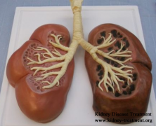 How to Shrink Kidney Cyst with PKD