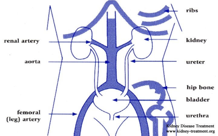 Kidney Failure:Treatment for High Phosphorus