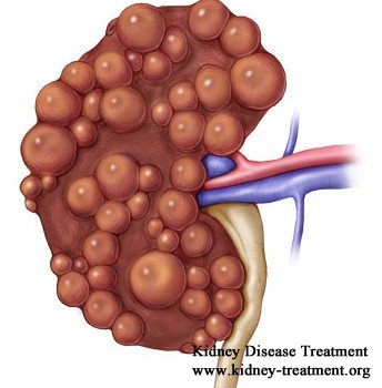 Natural Treatment for Creatinine 4 in Polycystic Kidney Disease