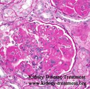 5th Stage Kidney Disease Due to Lupus Is There Any Natural Medicine
