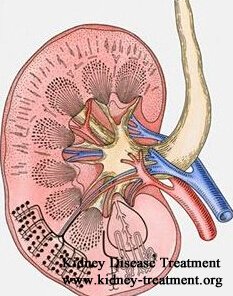 Nephrotic Syndrome & Kidney Function 8% Is There Any Natural Option