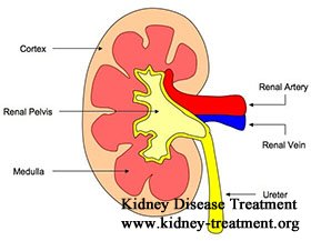 Stage 4 Kidney Disease from IgAN: How to Avoid Dialysis