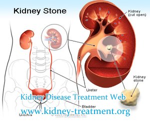 Can Kidney Stones Affect the Creatinine Level in Blood