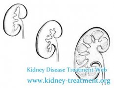 Shrinking Kidney Means What and How to Treat It