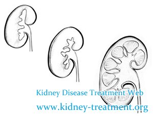 Shrinking Kidney Means What and How to Treat It