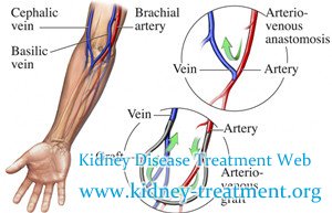 Can Dialysis Help Patients with Kidney Failure and Diabetes Get out of It