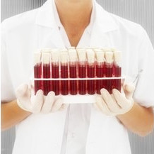 High Serum Creatinine Level What are the Symptoms and the Ways to Treat It
