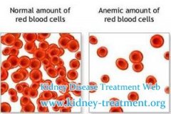 How is Anemia Related to Chronic Kidney Disease and How to Treat It