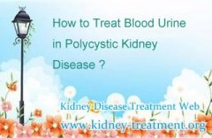 How to Treat Blood Urine in Polycystic Kidney Disease