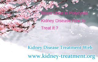 Blood Urine in Polycystic Kidney Disease How to Treat It