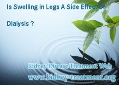 Is Swelling in Legs A Side Effect Of Dialysis
