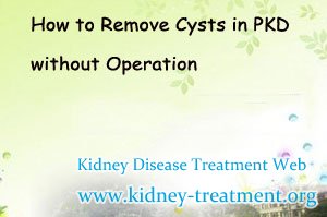 How to Remove Cysts in PKD without Operation