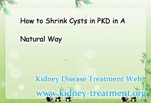 How to Shrink Cysts in PKD in A Natural Way