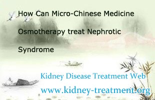 Nephrotic Syndrome Treatment,Nephrotic Syndrome,Micro-Chinese Medicine Osmotherapy