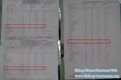 Stage 4 Kidney Disease Patient with Creatinine 445 Avoid Dialysis Successfully