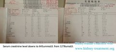 5 Years Discontinuity Lower Extremities Edema Disappeared after Taking Chinese Meidicne Treatment