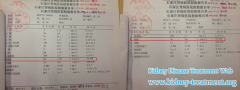 10 Years Proteinurine in Kidney Failure Disappeared