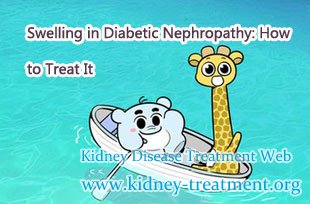 Swelling in Diabetic Nephropathy: How to Treat It