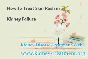 How to Treat Skin Rash in Kidney Failure