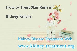 How to Treat Skin Rash in Kidney Failure