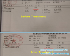 Can Hypertension with Kidney Disease Got Controlled